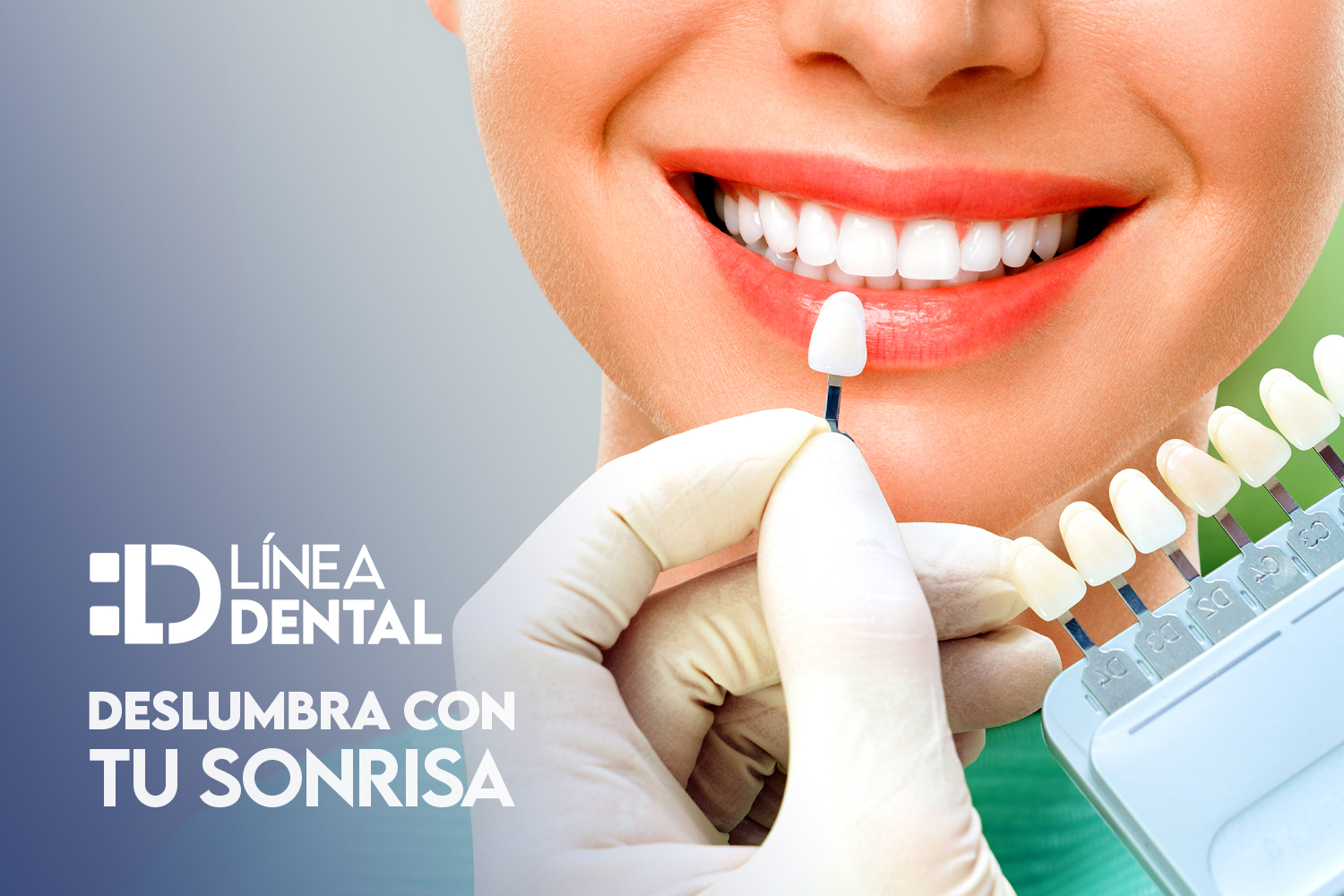 sonrisas-mas-blancas-blanqueamiento-dental-mejor-clinica-linea-dental-ciudad-real-miguelturra