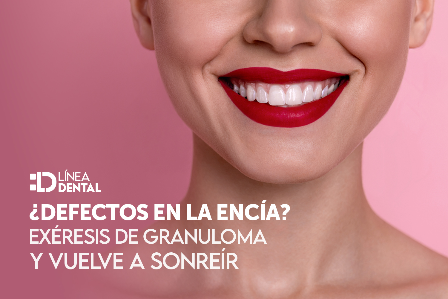01-exeresis-granuloma-dentista-odontologo-linea-dental-ciudad-real-miguelturra