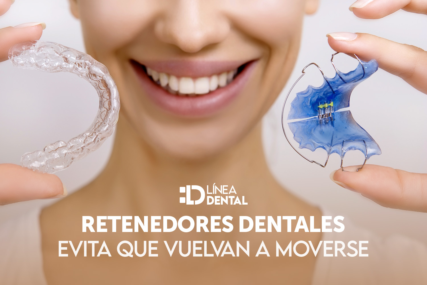 01-retenedores-dentales-dentista-odontologo-linea-dental-ciudad-real-miguelturra