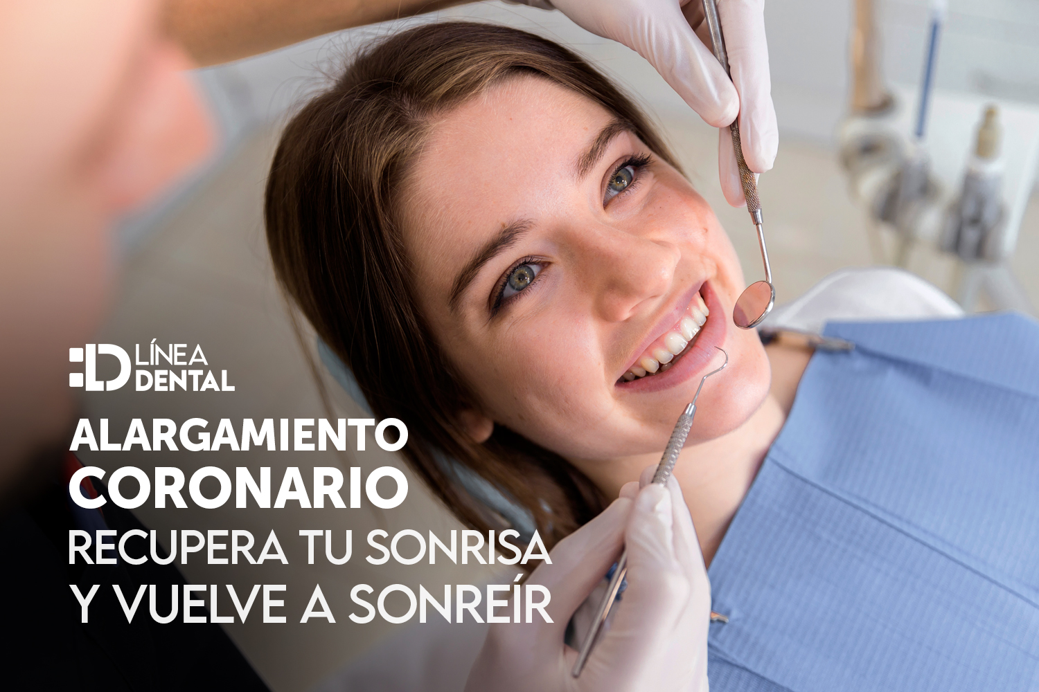 alargamiento-coronario-dentista-odontologo-linea-dental-ciudad-real-miguelturra
