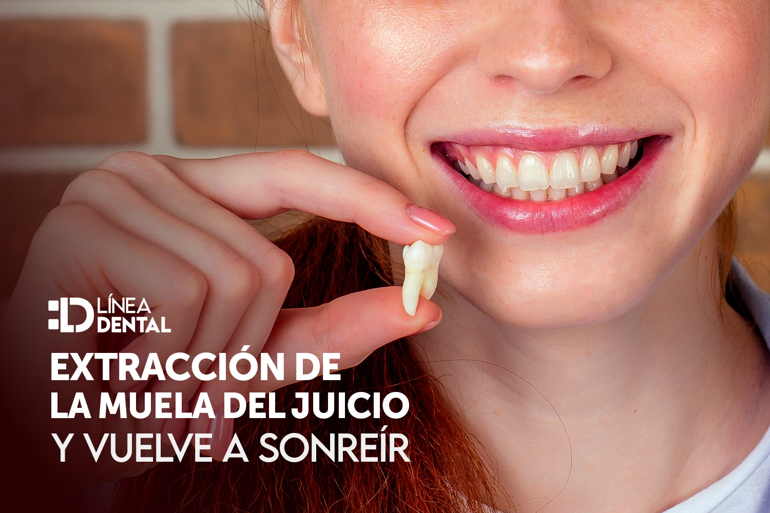 extraccion-muela-juicio-dentista-odontologo-linea-dental-ciudad-real-miguelturra