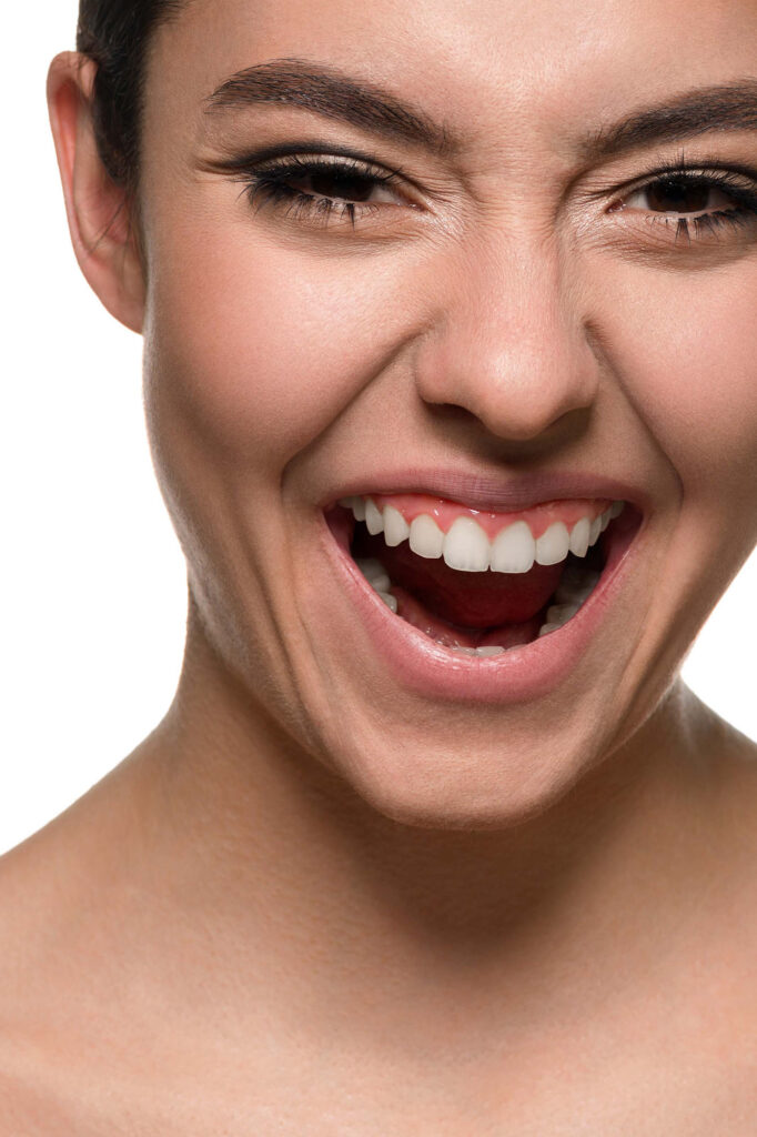 ¿En qué consiste la Gigivectomía? La Gigivectomía es un procedimiento odontológico que consiste en la eliminación quirúrgica selectiva del tejido gingival (encías) para mejorar la estética de la sonrisa y, en algunos casos, corregir problemas periodontales. Línea Dental Ciudad Real y Miguelturra