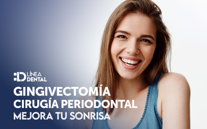 Ventajas de la Gigivectomía: Mejora Estética: Redefine la proporción entre dientes y encías para lograr una sonrisa más armoniosa. Línea Dental Ciudad Real y Miguelturra