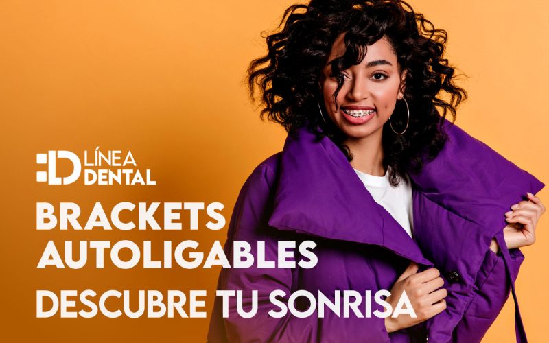 brackets-autoligasbles-ortodoncia-fija-linea-dental-ciudad-real-miguelturra
