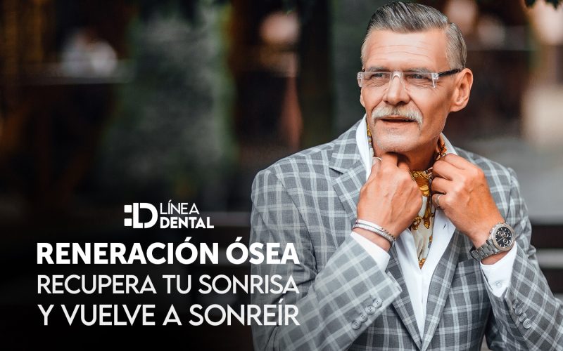 regeneracion-osea-implante-dental-dentista-odontologo-linea-dental-ciudad-real-miguelturra