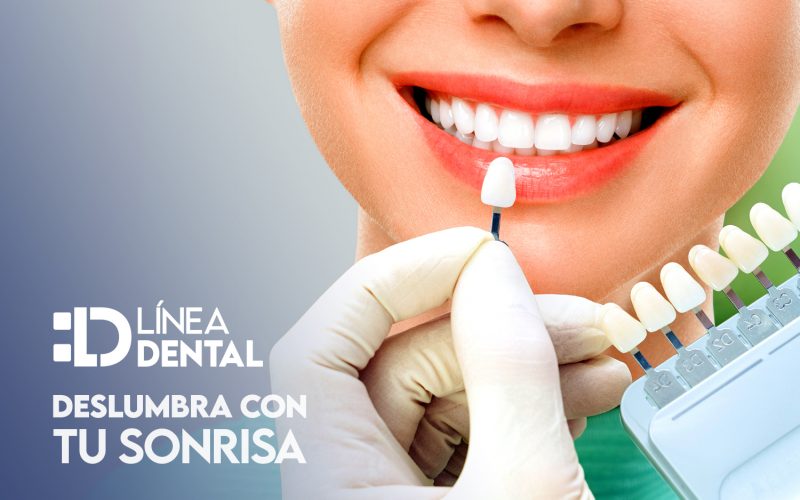 El blanqueamiento dental es un procedimiento no invasivo diseñado para eliminar manchas y decoloraciones, devolviendo a tus dientes su blancura natural. Línea Dental Ciudad Real y Miguelturra